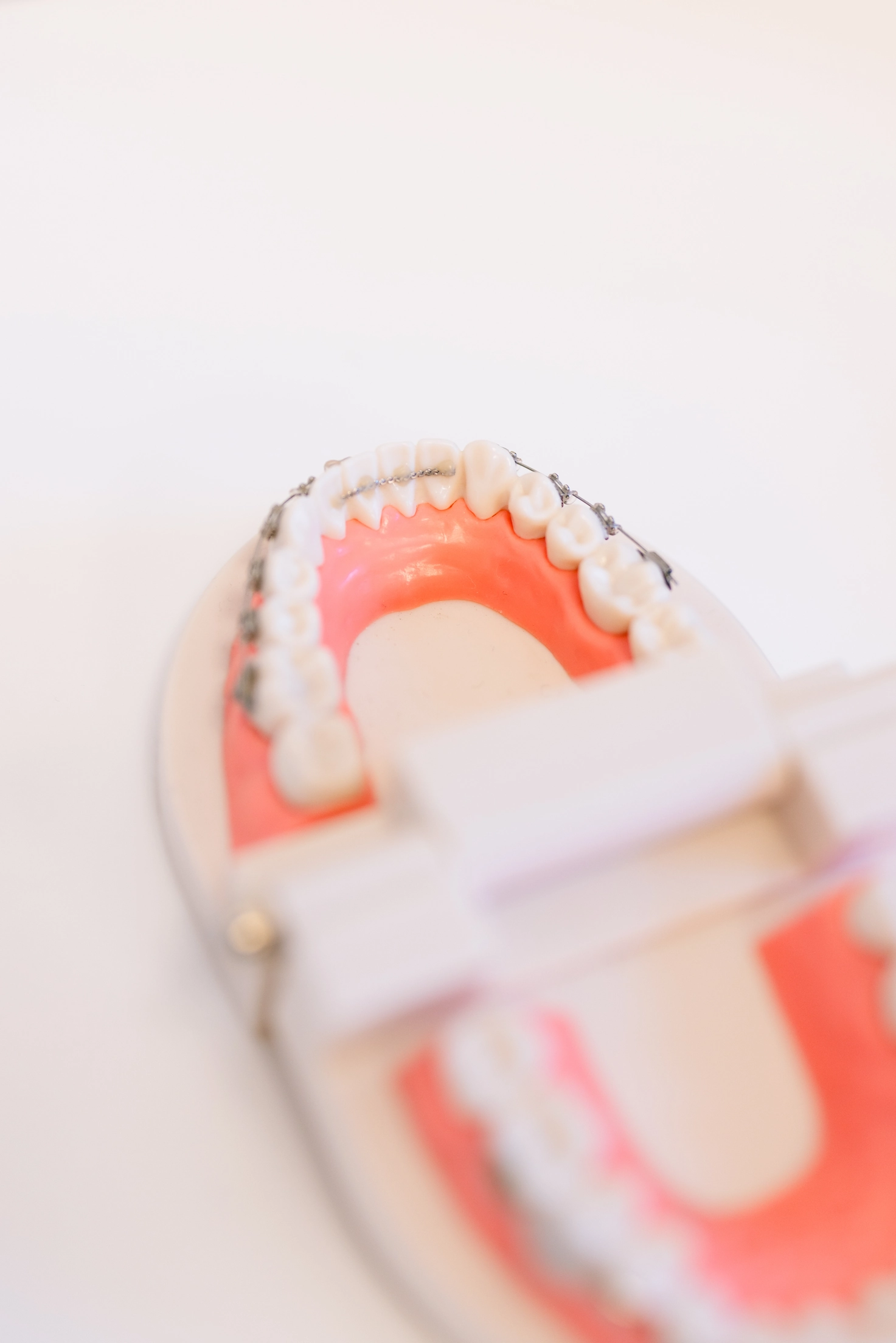 Contention orthodontique